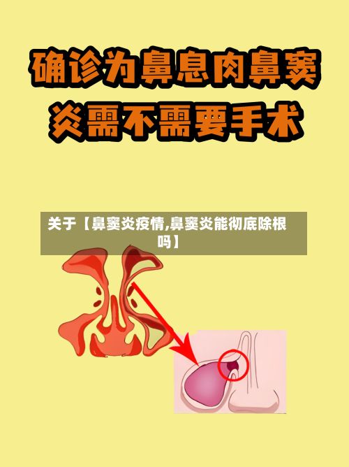 关于【鼻窦炎疫情,鼻窦炎能彻底除根吗】-第1张图片